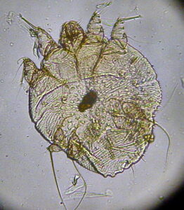 microscopische opname van schurftmijt (scabiës)